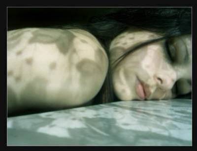 Suicide